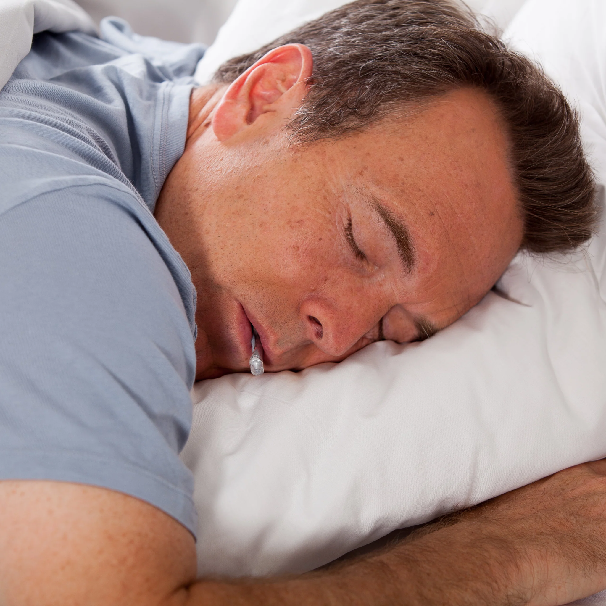 myTAP Oral Appliance for Sleep Apnea